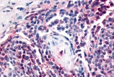 Immunohistochemistry-Paraffin: Attractin Antibody [NBP3-14547] - Immunohistochemistry of formalin-fixed, paraffin-embedded human spleen tissue after heat-induced antigen retrieval.